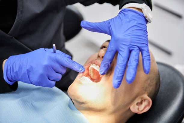Best Emergency Tooth Extraction in Paducah, TX